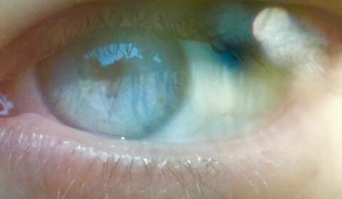 Absence reciprocity zranitelnosti, ztrát i rizik